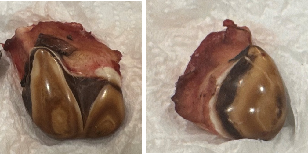 تم سحب صورتين لأسنان الأيائل من الفك وعرضها.