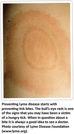 الطفح الجلدي